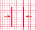 Accurate Gridline
